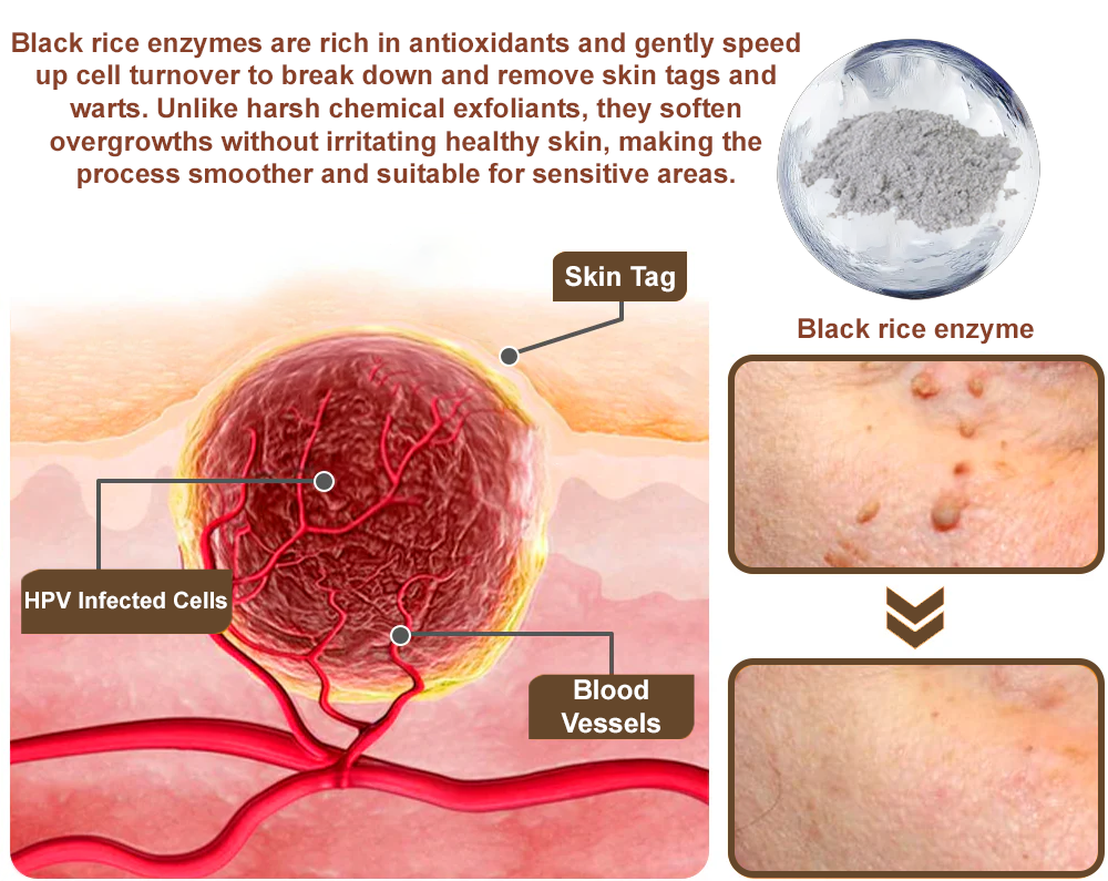 Pureluxo®Black Rice Skin Repair Essence Cream — FDA-Certified Skin Growth & Damage Treatment (For warts, seborrheic keratosis, skin tags, keratin buildup, hyperpigmentation, age spots, hyperplasia, etc.)