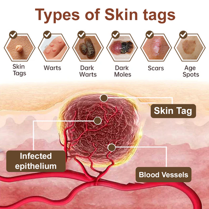 Pureluxo®Black Rice Skin Repair Essence Cream — FDA-Certified Skin Growth & Damage Treatment (For warts, seborrheic keratosis, skin tags, keratin buildup, hyperpigmentation, age spots, hyperplasia, etc.)