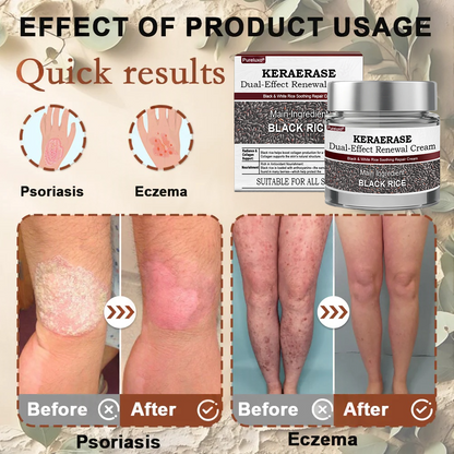 Pureluxo®Black Rice Skin Repair Essence Cream — FDA-Certified Skin Growth & Damage Treatment (For warts, seborrheic keratosis, skin tags, keratin buildup, hyperpigmentation, age spots, hyperplasia, etc.)