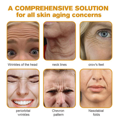 (Made and Shipped from USA) 🧑‍⚕️TLOPA® Botox Bee Venom Wrinkle Removal Cream- LAST DAY 70% OFF🧑‍⚕️