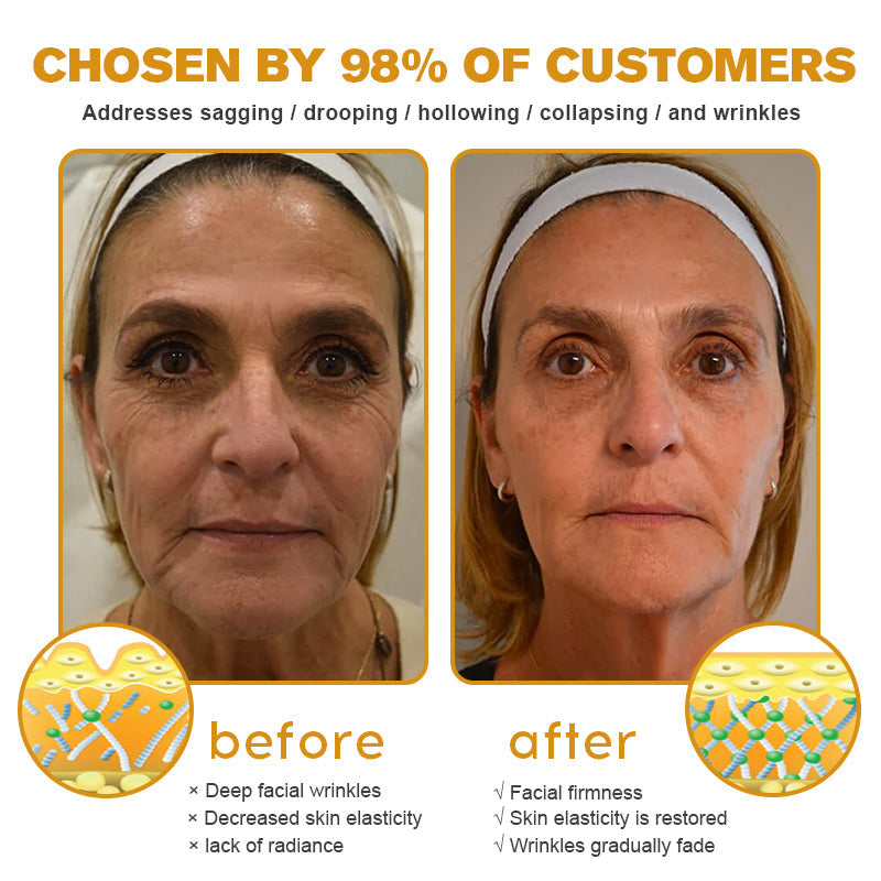 (Made and Shipped from USA) 🧑‍⚕️TLOPA® Botox Bee Venom Wrinkle Removal Cream- LAST DAY 70% OFF🧑‍⚕️