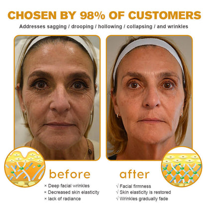 (Made and Shipped from USA) 🧑‍⚕️TLOPA® Botox Bee Venom Wrinkle Removal Cream- LAST DAY 70% OFF🧑‍⚕️